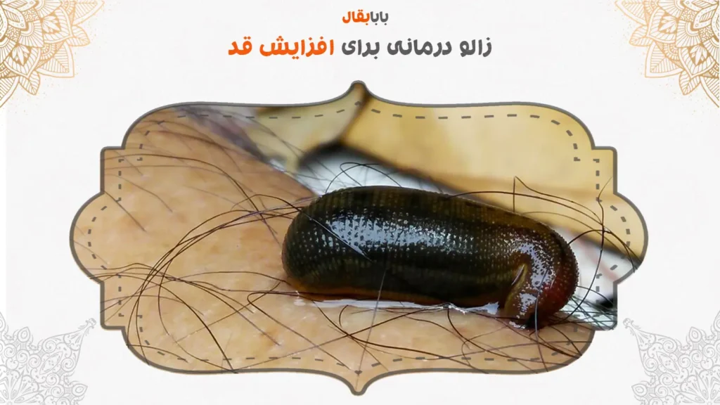 زالو درمانی برای افزایش قد